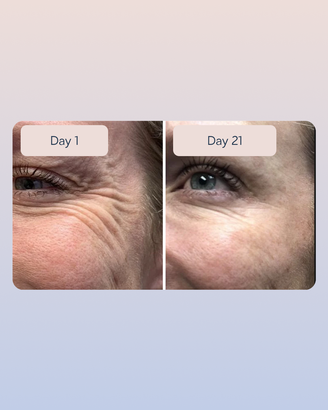 Golden Retinol Eye Cream (Copy)
