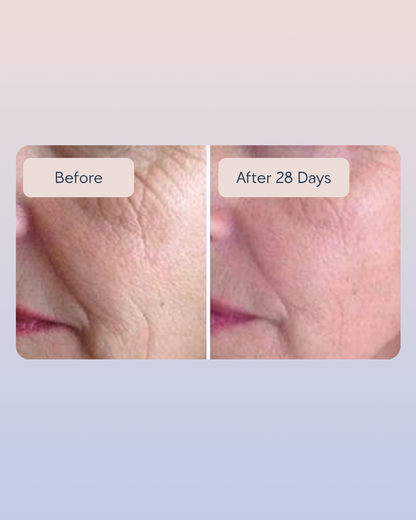 Golden Retinol Eye Cream (Copy)