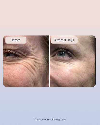 6 Golden Retinol Eye Serum