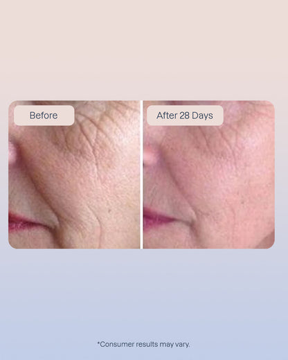 6 Golden Retinol Eye Serum